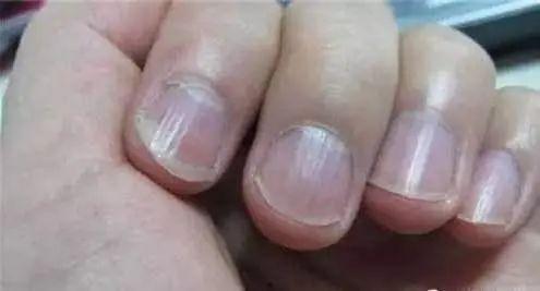 兰陵吃指甲盖的瓜视频,挑战极限的美食冒险